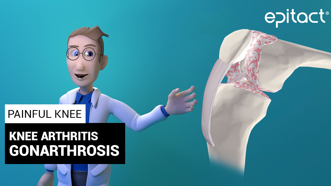 gonarthrosis_epitact_painful knee