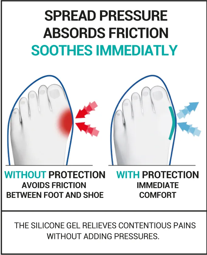 Hallux Valgus daily protection