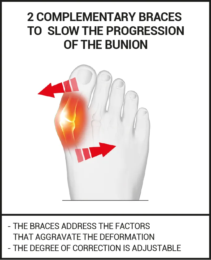 DUO of DAY & NIGHT CORRECTION for HALLUX VALGUS
