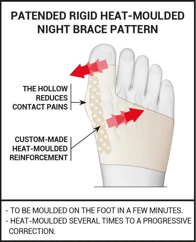 DUO of DAY & NIGHT CORRECTION for HALLUX VALGUS