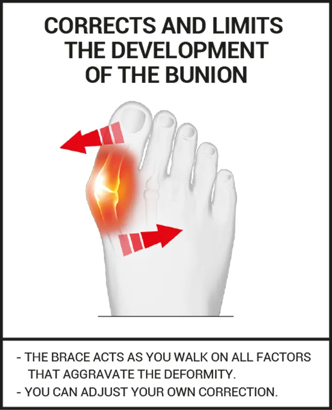 Hallux Valgus Corrective brace